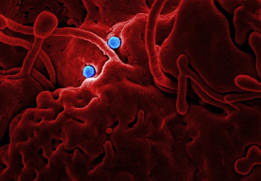 Can Vein Valves Heal?