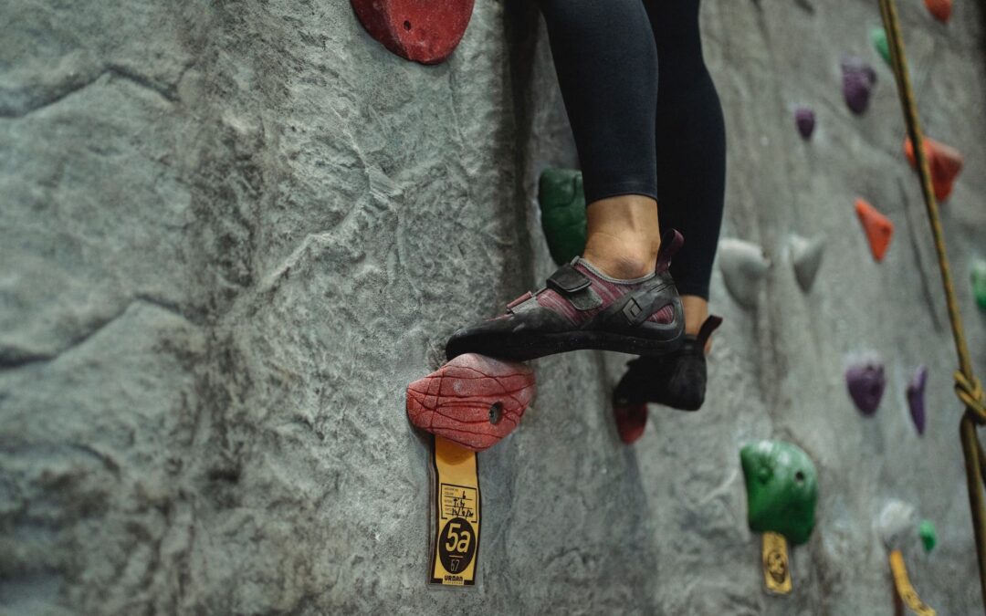 When Should I Worry about Spider Veins?