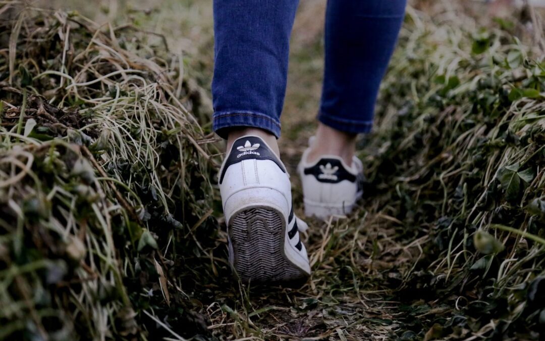 10 Early Signs of Varicose Veins and How to Stop Them In Their Tracks