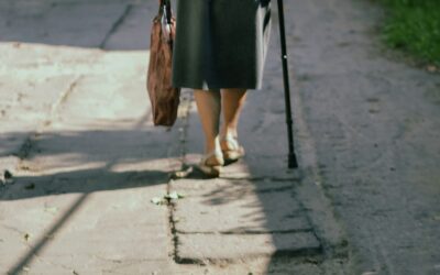 Varicose Veins and Aging: What You Need to Know, and What You Can Do About It